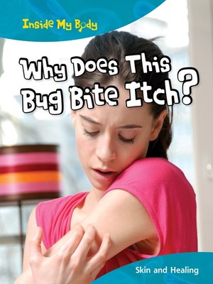 cover image of Why Does This Bug Bite Itch?